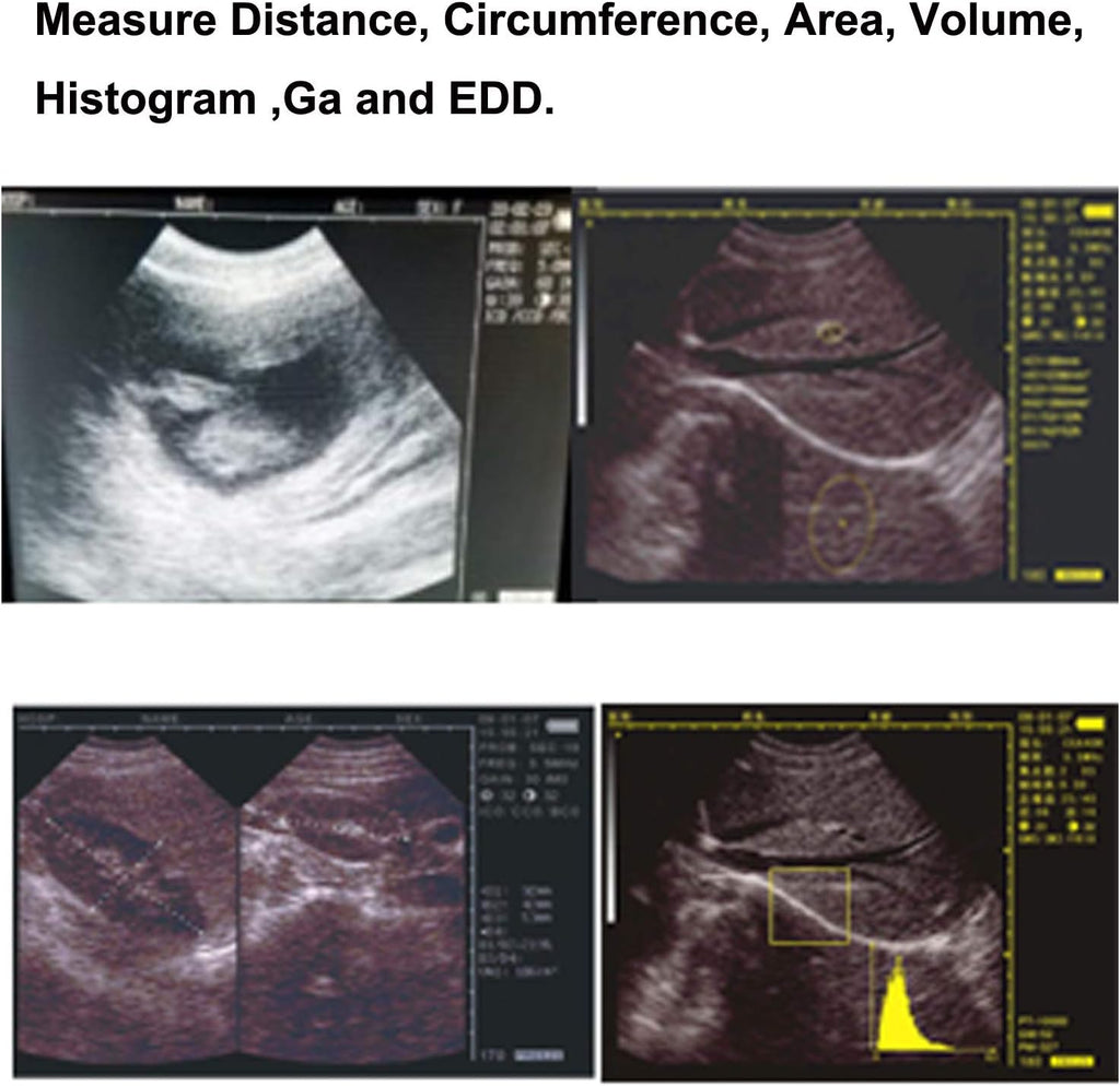 Veterinary Ultrasound Scanner Kit Rechargeable with 3.5MHz Probe J589069