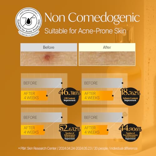 Italian White Truffle First Spray Serum, Vegan Skin Care, Hydrating Face Moisturizer, Glow Serum, Non Comedogenic, All In One Mist, Korean Skin Care (3.38 fl oz.) N5089